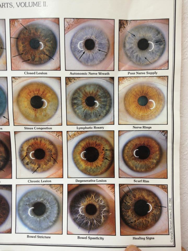 Iridology Reference GrapeGate