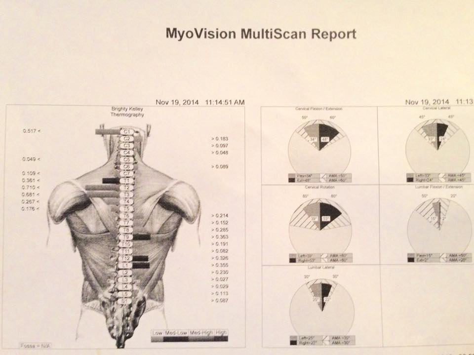 MyoVision Multiscan Report #2