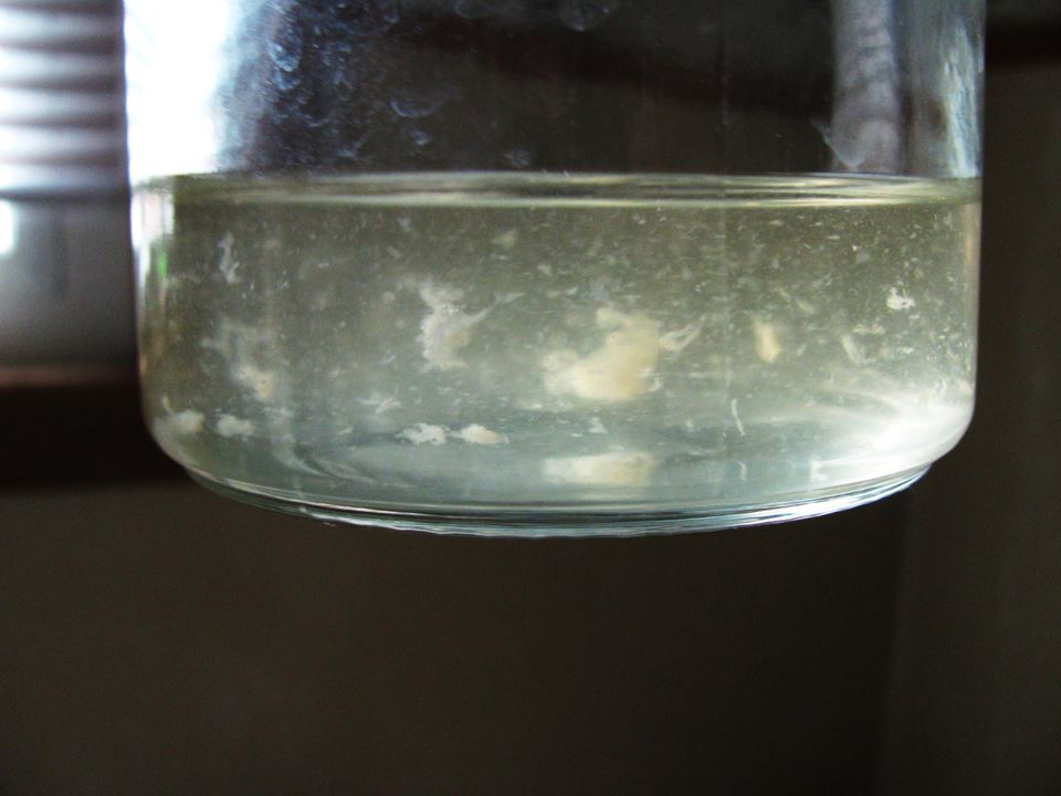 white particles in urine