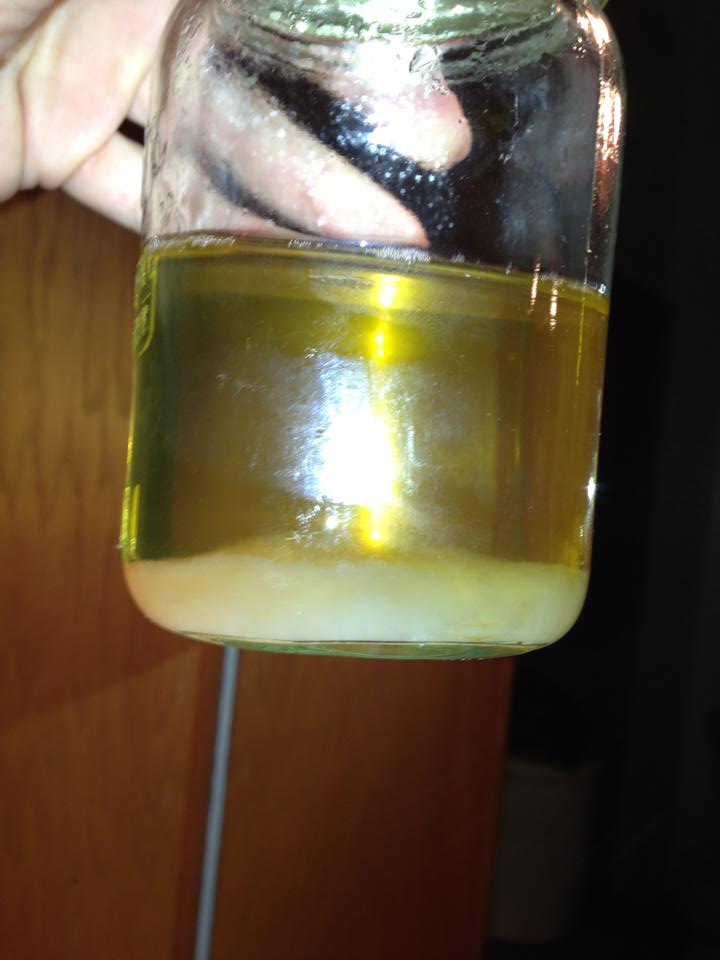 particles in urine