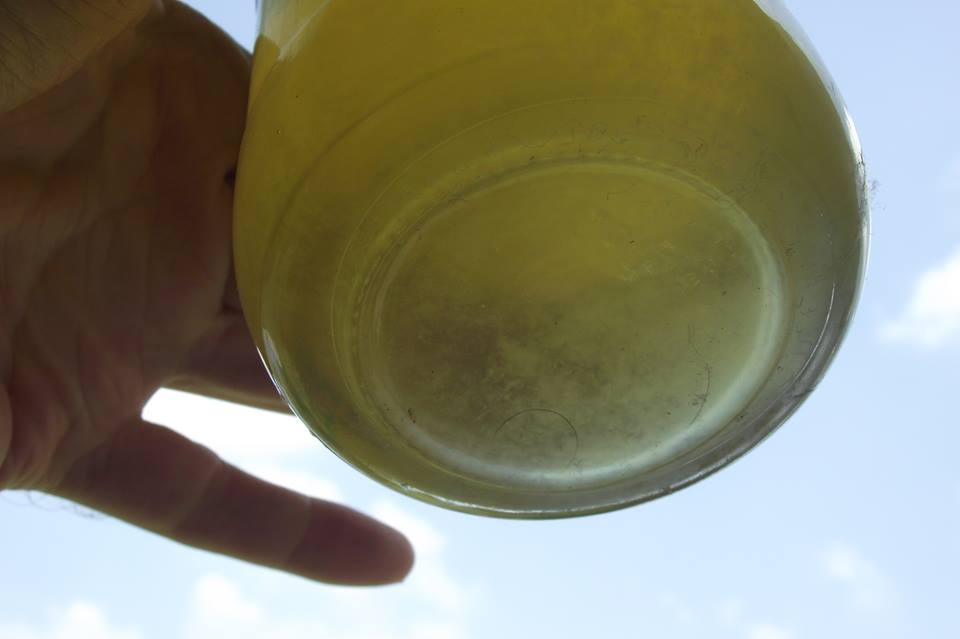 Зеленая моча. Sediment in Cup. Urine pouring first person. Zovodga ishch Urin erkutiskidaborligi.