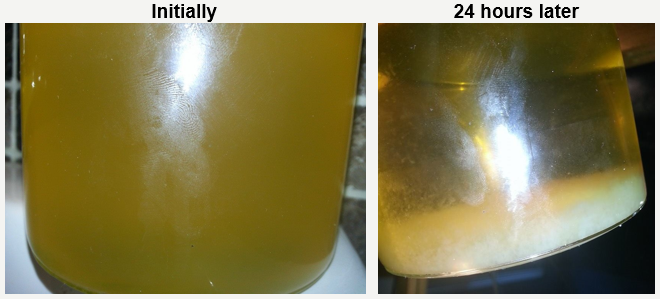 pictures of white particles in urine